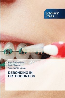 Debonding in Orthodontics 1
