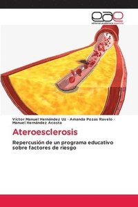 bokomslag Ateroesclerosis