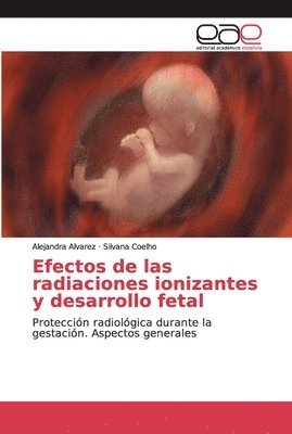 Efectos de las radiaciones ionizantes y desarrollo fetal 1