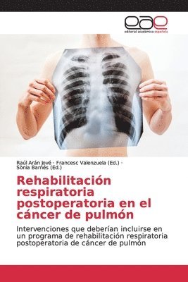 bokomslag Rehabilitacin respiratoria postoperatoria en el cncer de pulmn