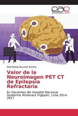 Valor de la Neuroimagen PET CT de Epilepsia Refractaria 1