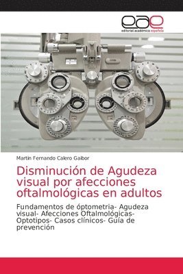 bokomslag Disminucin de Agudeza visual por afecciones oftalmolgicas en adultos