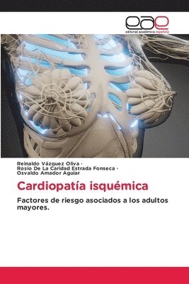 bokomslag Cardiopata isqumica