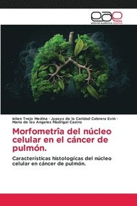 bokomslag Morfometrîa del núcleo celular en el cáncer de pulmón.