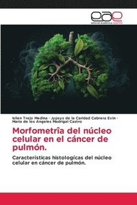 bokomslag Morfometrîa del núcleo celular en el cáncer de pulmón.