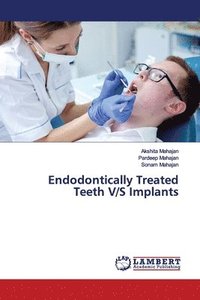 bokomslag Endodontically Treated Teeth V/S Implants