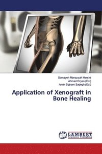 bokomslag Application of Xenograft in Bone Healing