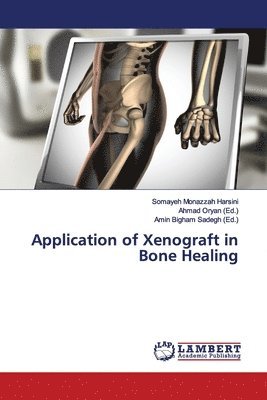 Application of Xenograft in Bone Healing 1