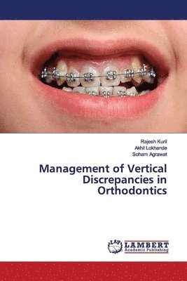 bokomslag Management of Vertical Discrepancies in Orthodontics