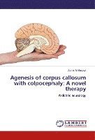 Agenesis of corpus callosum with colpocephaly 1
