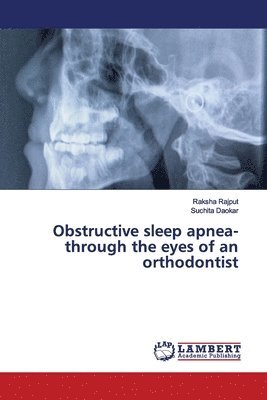 Obstructive sleep apnea- through the eyes of an orthodontist 1