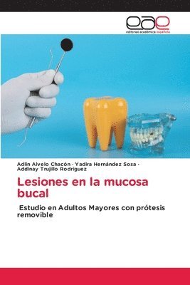 Lesiones en la mucosa bucal