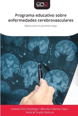 bokomslag Programa educativo sobre enfermedades cerebrovasculares