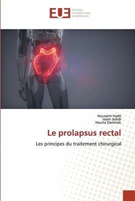Le prolapsus rectal 1
