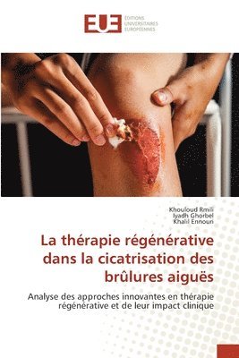 La thérapie régénérative dans la cicatrisation des brûlures aiguës 1