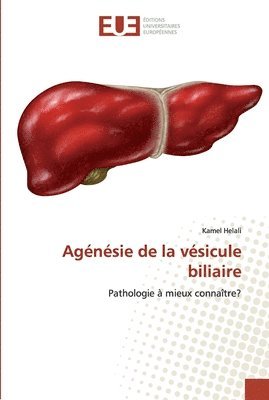Agnsie de la vsicule biliaire 1