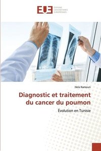 bokomslag Diagnostic et traitement du cancer du poumon