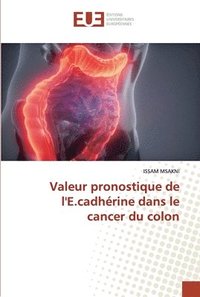 bokomslag Valeur pronostique de l'E.cadhrine dans le cancer du colon
