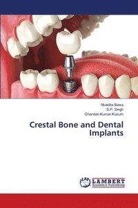 bokomslag Crestal Bone and Dental Implants