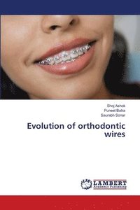 bokomslag Evolution of orthodontic wires