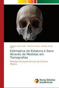 bokomslag Estimativa de Estatura e Sexo Atravs de Medidas em Tomografias