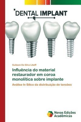 Influncia do material restaurador em coroa monoltica sobre implante 1