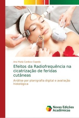 bokomslag Efeitos da Radiofrequncia na cicatrizao de feridas cutneas