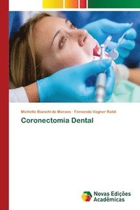 bokomslag Coronectomia Dental