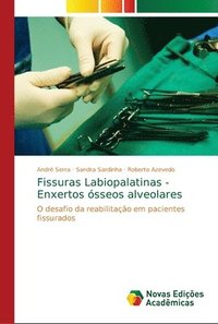 bokomslag Fissuras Labiopalatinas - Enxertos sseos alveolares