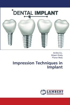 Impression Techniques in Implant 1