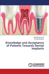 bokomslag Knowledge and Acceptance of Patients Towards Dental Implants