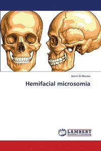 bokomslag Hemifacial microsomia