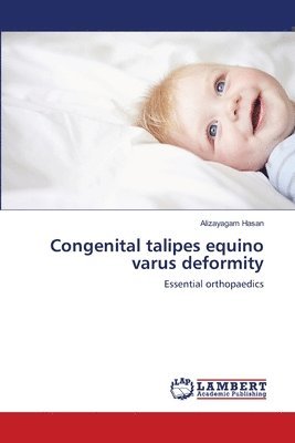 Congenital talipes equino varus deformity 1