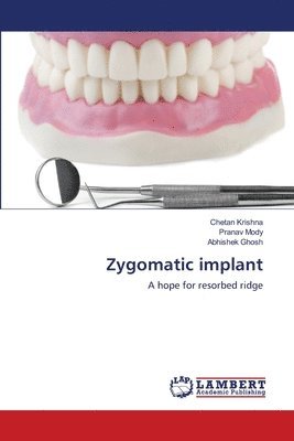 bokomslag Zygomatic implant