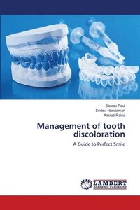 bokomslag Management of tooth discoloration