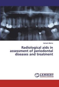 bokomslag Radiological aids in assessment of periodontal diseases and treatment