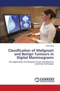 bokomslag Classification of Malignant and Benign Tumours in Digital Mammograms