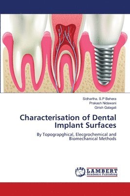 Characterisation of Dental Implant Surfaces 1