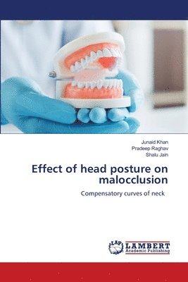 bokomslag Effect of head posture on malocclusion