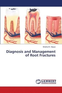 bokomslag Diagnosis and Management of Root Fractures