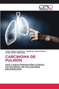 bokomslag Carcinoma de Pulmón