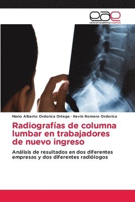 Radiografías de columna lumbar en trabajadores de nuevo ingreso 1