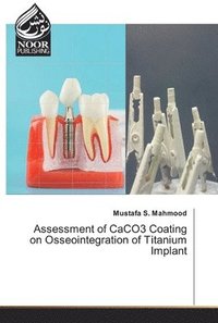 bokomslag Assessment of CaCO3 Coating on Osseointegration of Titanium lmplant