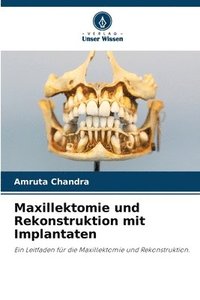 bokomslag Maxillektomie und Rekonstruktion mit Implantaten