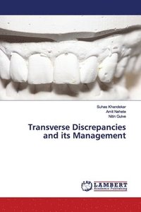bokomslag Transverse Discrepancies and its Management