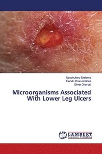 bokomslag Microorganisms Associated With Lower Leg Ulcers