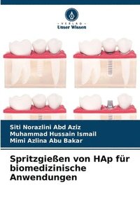 bokomslag Spritzgieen von HAp fr biomedizinische Anwendungen