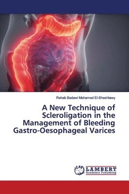 A New Technique of Scleroligation in the Management of Bleeding Gastro-Oesophageal Varices 1