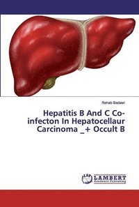 bokomslag Hepatitis B And C Co-infecton In Hepatocellaur Carcinoma _+ Occult B