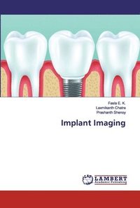 bokomslag Implant Imaging